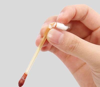 当身体出现伤口可以用碘伏消毒吗 当身体出现伤口可以用碘伏消毒吗