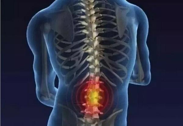检查腰椎是否健康要检查哪些方面