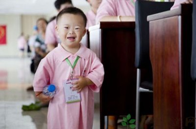 小孩患有唐氏综合症会有哪些明显症状