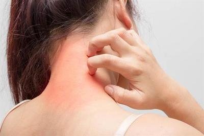 秋冬季节皮肤瘙痒多发我们应该如何预防