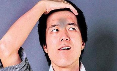 印堂指的是哪印堂发黑是疾病的征兆吗