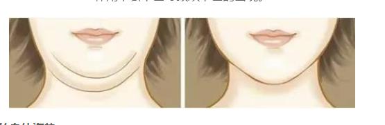 为什么会长双下巴的几种原因
