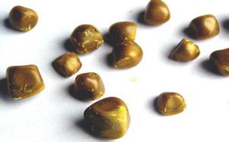 结石患者适合喝什么茶来治疗结石