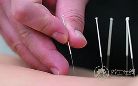 找准针灸减肥五大穴位 塑造纤细身姿