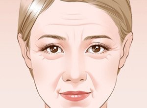 能够有效去除面部皱纹的几个方法