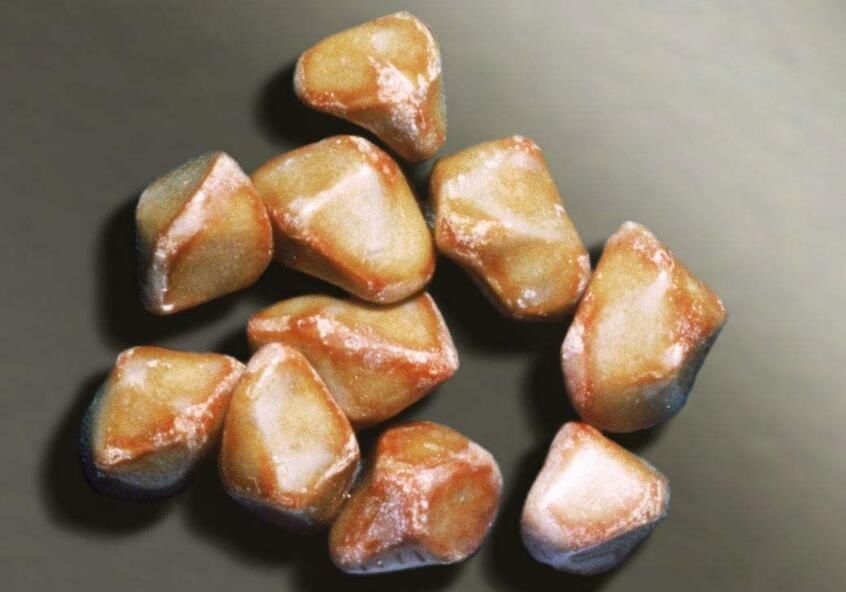 胆固醇结石要采取怎样的方法治疗